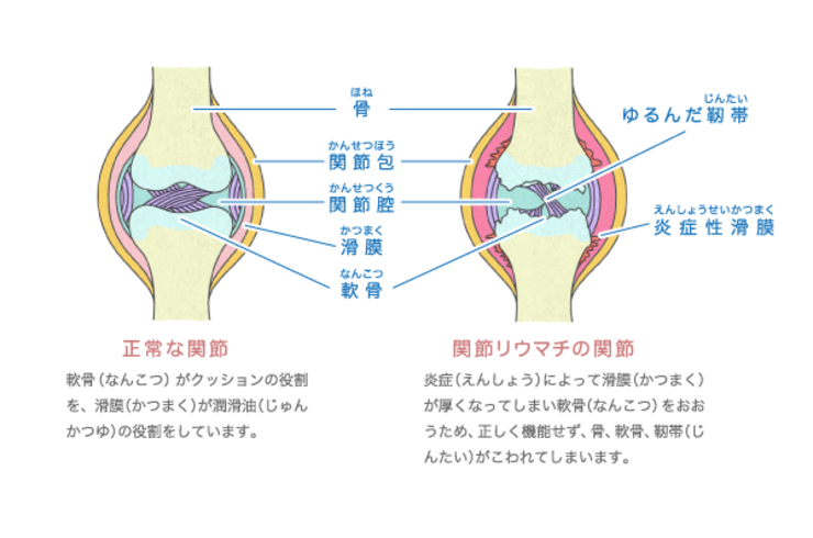 名古屋市の南区で猫背、姿勢改善専門の整体を行う「トータルボディケアほほえみ整体院」の健康情報