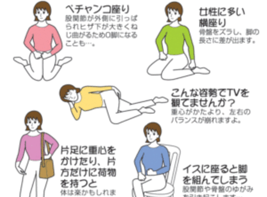 名古屋市の整体のNG姿勢
