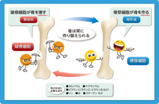 リモデリング図.png